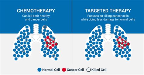 Lung Cancer Cells Vs Normal Cells