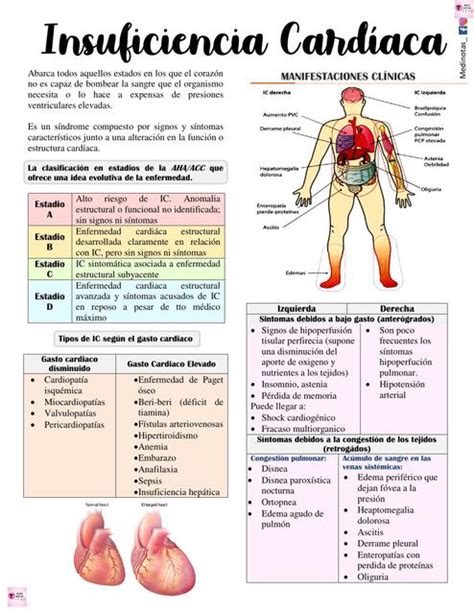 Insuficiencia Cardíaca Apuntes de cardiología Medicina uDocz