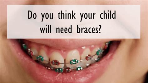 Generally, you get it for health related reasons, but also aesthetics, but only if sufficiently bad. How to Tell if Your Child Needs Braces | Families Magazine