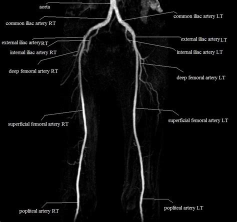 The anatomical areas found on the upper limb can serve as key landmarks to help us find important anatomical structures such as finding one of the superficial veins: Leg artery anatomy. Cardiovascular System of the Leg and ...