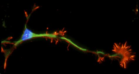 Nerve Regeneration: Nerve Regeneration Gene