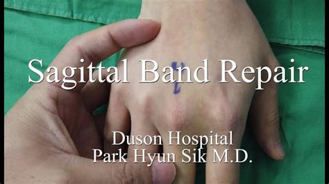 Surgical Procedure Of Sagittal Band Repair Youtube