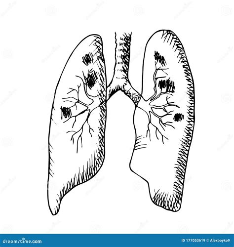 Vector Black And White Illustration Of A Lung Affected By A Disease
