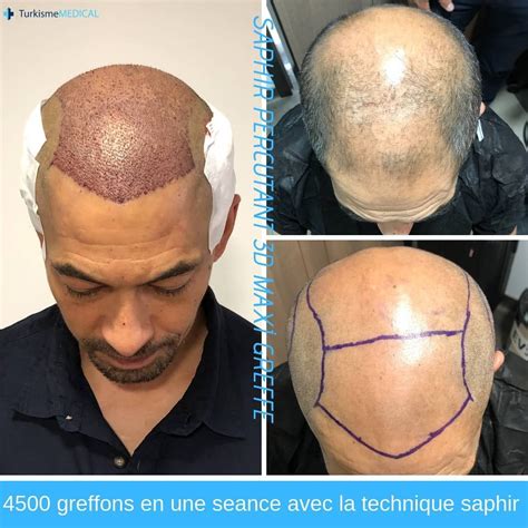 L'oréal Paris, Mens Hairstyles, Mens Fashion, Solution, Hair Styles, 3d