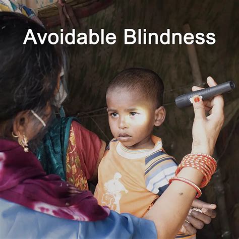 Avoidable Blindness Operation Eyesight