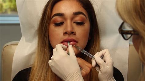 Keyhole Pout Injectable Procedure Youtube