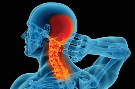 Understanding Neck Pain Causes Symptoms And Treatment Options