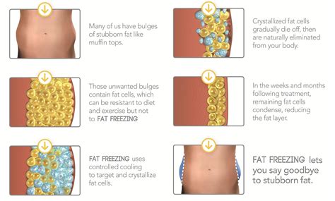 Freezing Fat Cells At Home Homemade Ftempo