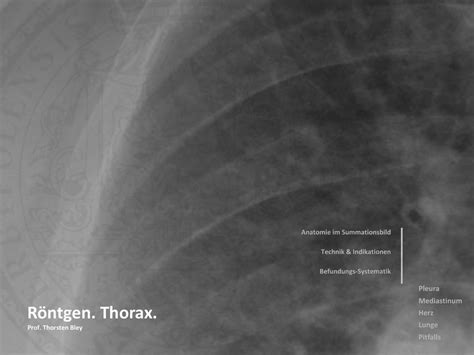 Check spelling or type a new query. Röntgen. Thorax.