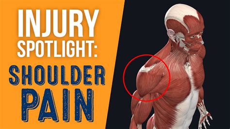 Shoulder Pain Anatomy Map 3 Specialist Shoulder Treatment © Fotolia