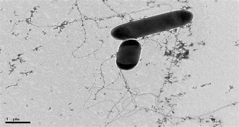 The severity of the disease depends on host factors and the. Salmonella Under the Microscope, The Infectious Diseases ...