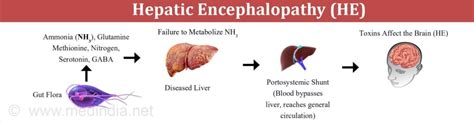 Hepatic Encephalopathy Acupuncture And The Effects On The Liver