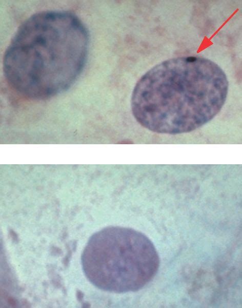 As in all animal cells, the cells of the human cheek do not possess a cell wall. Barr_body.html 07_09-Barr_body.jpg
