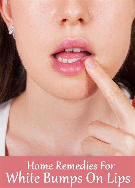 7 Home Remedies For White Bumps On Lips Search Home Remedy