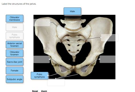 Solved Label The Structures Of The Pelvis Male Obturator Membrane
