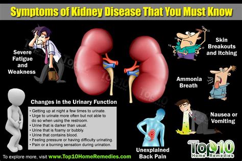 Top 10 Symptoms of Kidney Disease that You Need to Know | Top 10 Home Remedies
