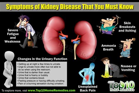 10 Symptoms That Should Alert You About Kidney Disease Top 10 Home
