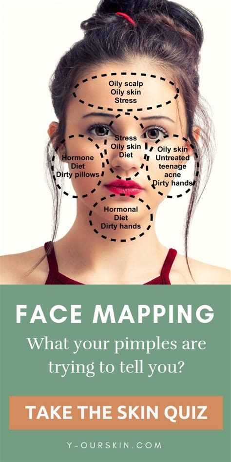 Face Mapping What Your Pimples Are Trying To Tell You Facial Skin