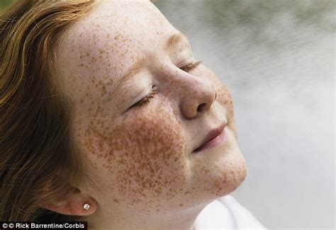 The Science Of Freckles Daily Mail Online