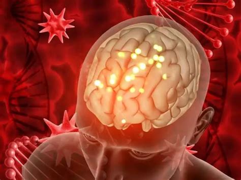 Blood Clot Brain Symptoms Diagnosis Treatment And NHS Insights