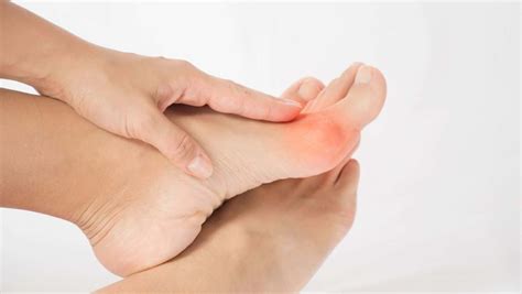 Bunion Pain What Causes Bunions Diagnosis And Home Treatment