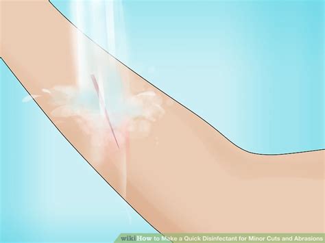 How To Make A Quick Disinfectant For Minor Cuts And Abrasions