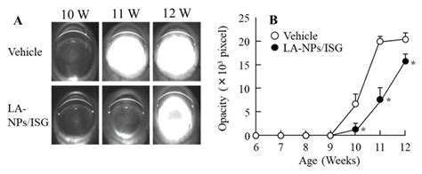 Lens Opacification Of Shumiya Cataract Rats With A Combination Of
