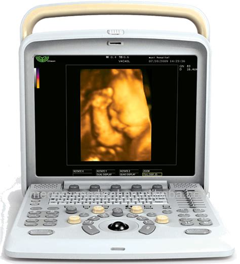 Medical Equipment Very Clear Imaging 3d 4d Portable Ultrasound Machine