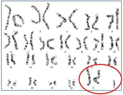 Karyotyping Queensland Fertility Group