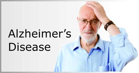 alzheimers disease cure  symptoms  risk factor
