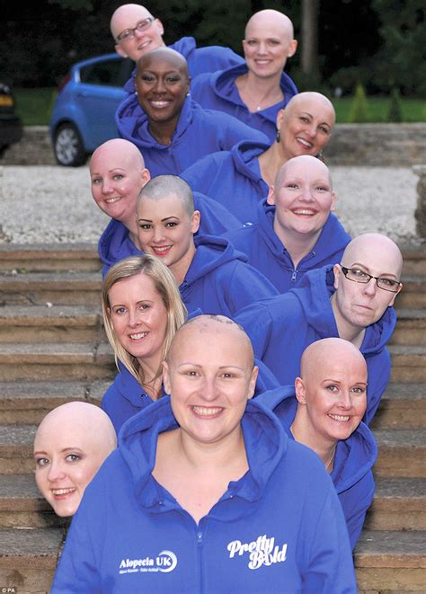 Bald Women Pose For Nude Calendar Raising Funds For Alopecia Uk Daily Mail Online