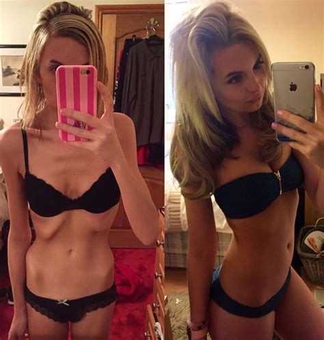 Anorexic Woman 23 Whose Weight Dropped To Just 6st Makes Incredible