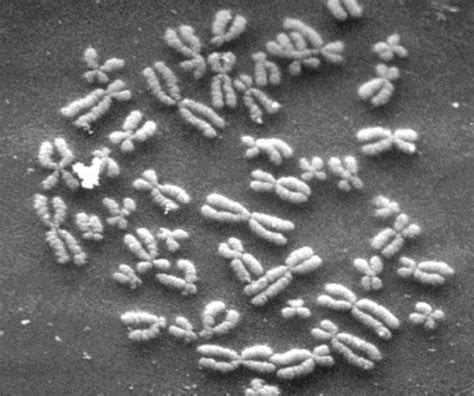 Electron Micrograph Of Chromosomes Human Genome Genetics Biology