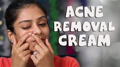 Acne Removal Cream How To Remove Acne Home Remedy Youtube