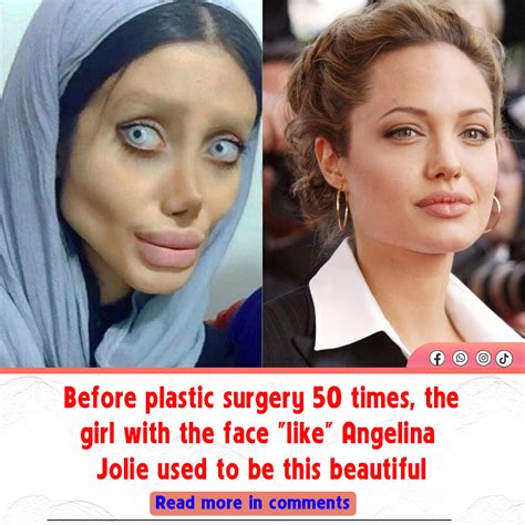 Before 50 Plastic Surgeries The Girl With The Face Like Angelina