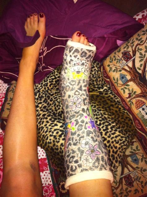 27 Best Images About Fabulous Leg Casts On Pinterest Henna Leopards And Hobby Lobby