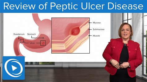 Review Of Peptic Ulcer Disease Pharmacology Lecturio Nursing YouTube