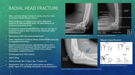 Radial Head Fracture Classification