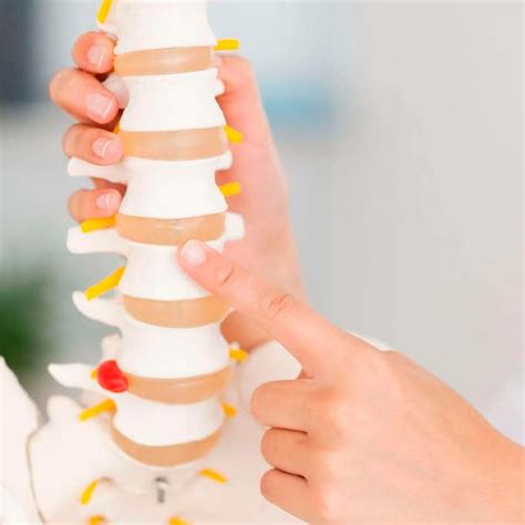 【fractura De Vértebra】⇨ Causas Síntomas Y Tratamiento