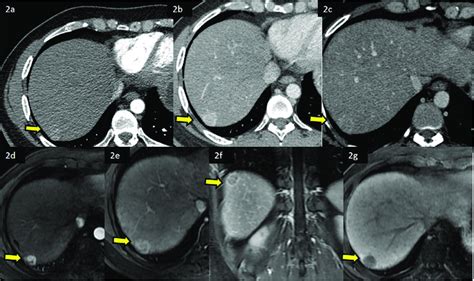 Dynamic Contrast Enhanced Ct Cect And Mri Cemri Scans Showing The Download Scientific Diagram