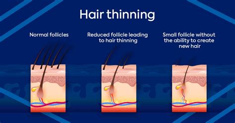 Why Is Your Hair Thinning Blog Kaloni