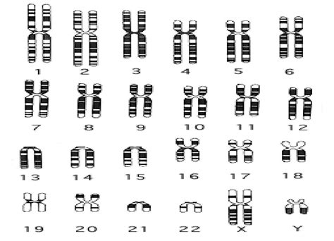Interpretation Of Picture Of Human Chromosomes Echemi