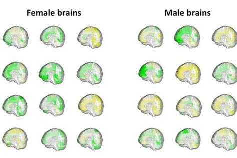 Scans Fail To Differentiate Between Male And Female Brains