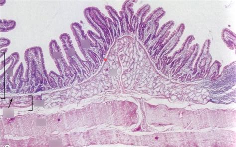 Histology Small Intestine Duodenum Histology Slides Medicine Notes