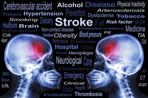 Fast Action Can Reduce Stroke Damage To The Brain Michigan Head