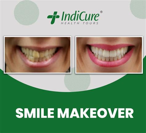 Smile Makeover In India Eddiemaiden Health Healthcare Medical