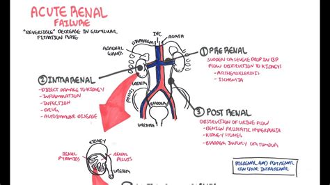 Neurological complications in renal failure: Acute Renal Failure - YouTube