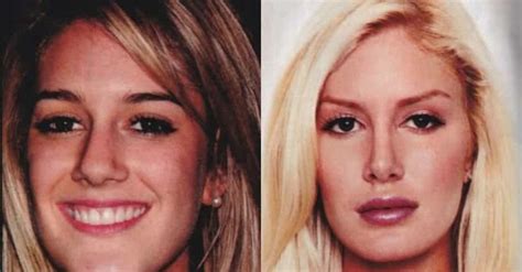 addicted to plastic surgery 12 biggest plastic surgery addicts