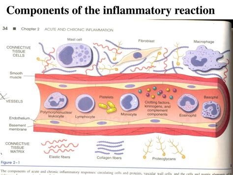 Ppt Acute Inflammation 1 Powerpoint Presentation Free Download Id