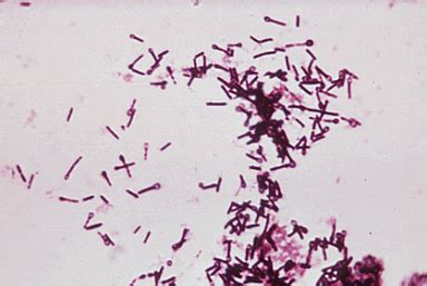 Clostridium tetani is a common soil bacterium and the causative agent of tetanus. Tétano em Animais - InfoEscola